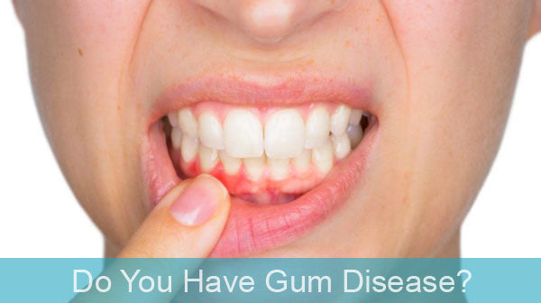 The Shocking Effects of Gum Disease and Your Health